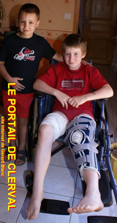 Lucas est courageux et garde le moral.